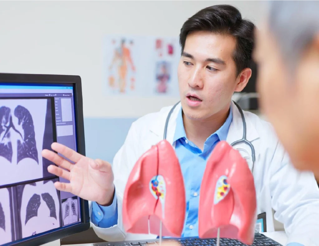 Lung Cancer in the US