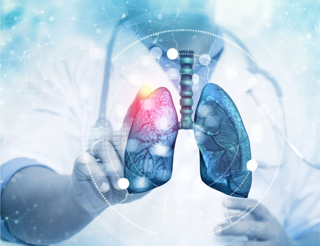 The Role of EHR in Lung Cancer Detection & Management