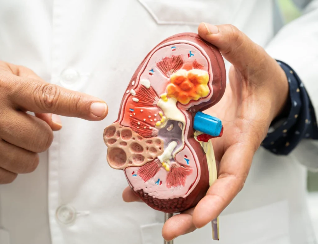 Understanding Nephrology Billing