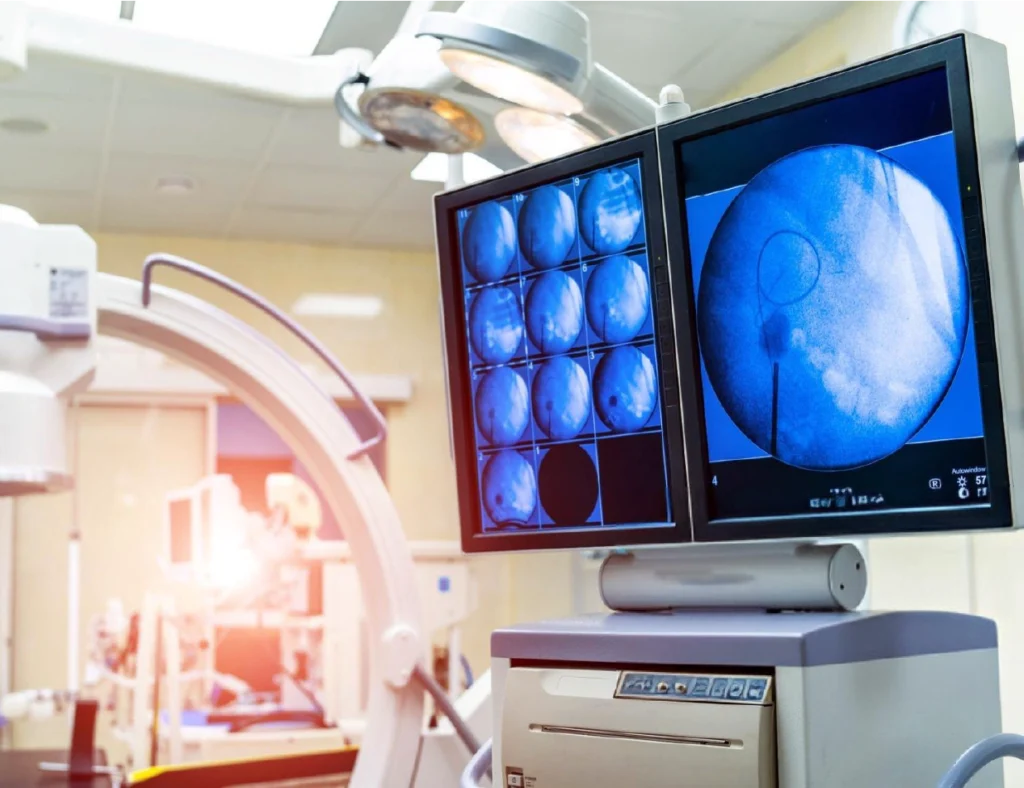 What Makes IR Billing So Complex